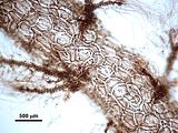 7 - Cellule corticali in visione superficiale